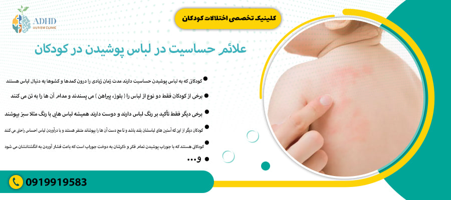 علائم حساسیت در لباس پوشیدن در کودکان